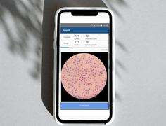 The SIHA AI Mobile-Based On-Device Medical Screener